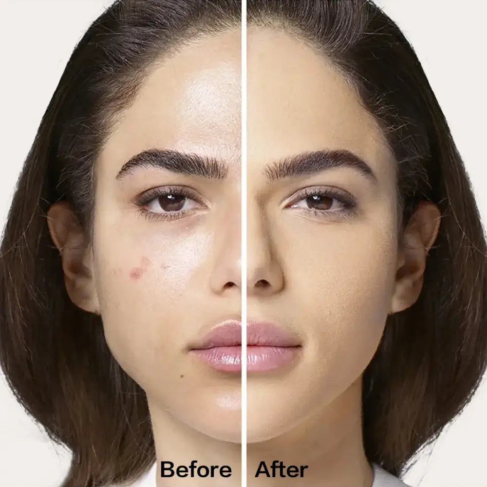 Split-screen comparison showing a woman’s face before and after makeup application or skin treatment.