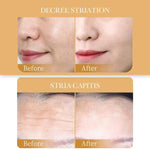 Collagen Face Mask with Before and After Results - Vignette | VogueBeautify