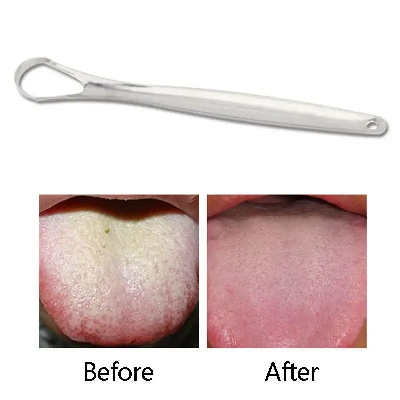 Tongue scraper with before and after images showing its effect on tongue cleanliness.