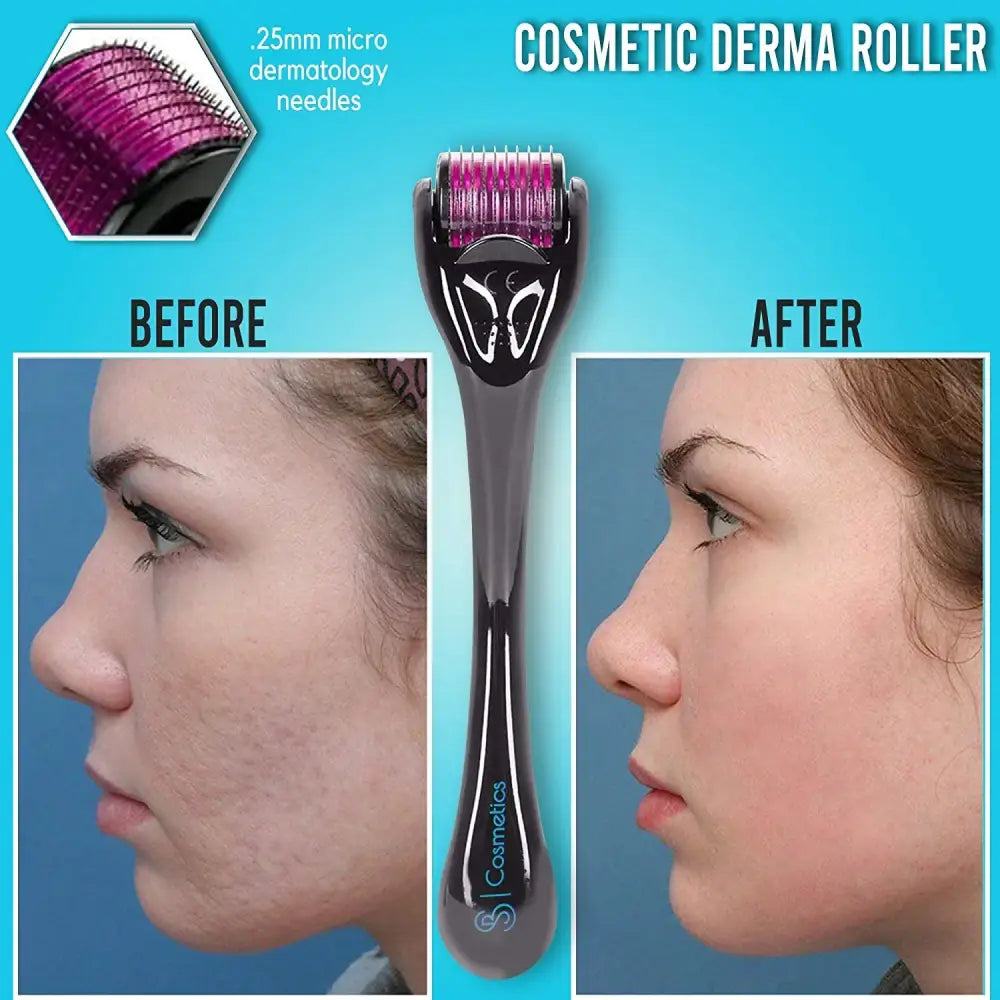 Cosmetic derma roller with before and after facial profile images demonstrating its effects.