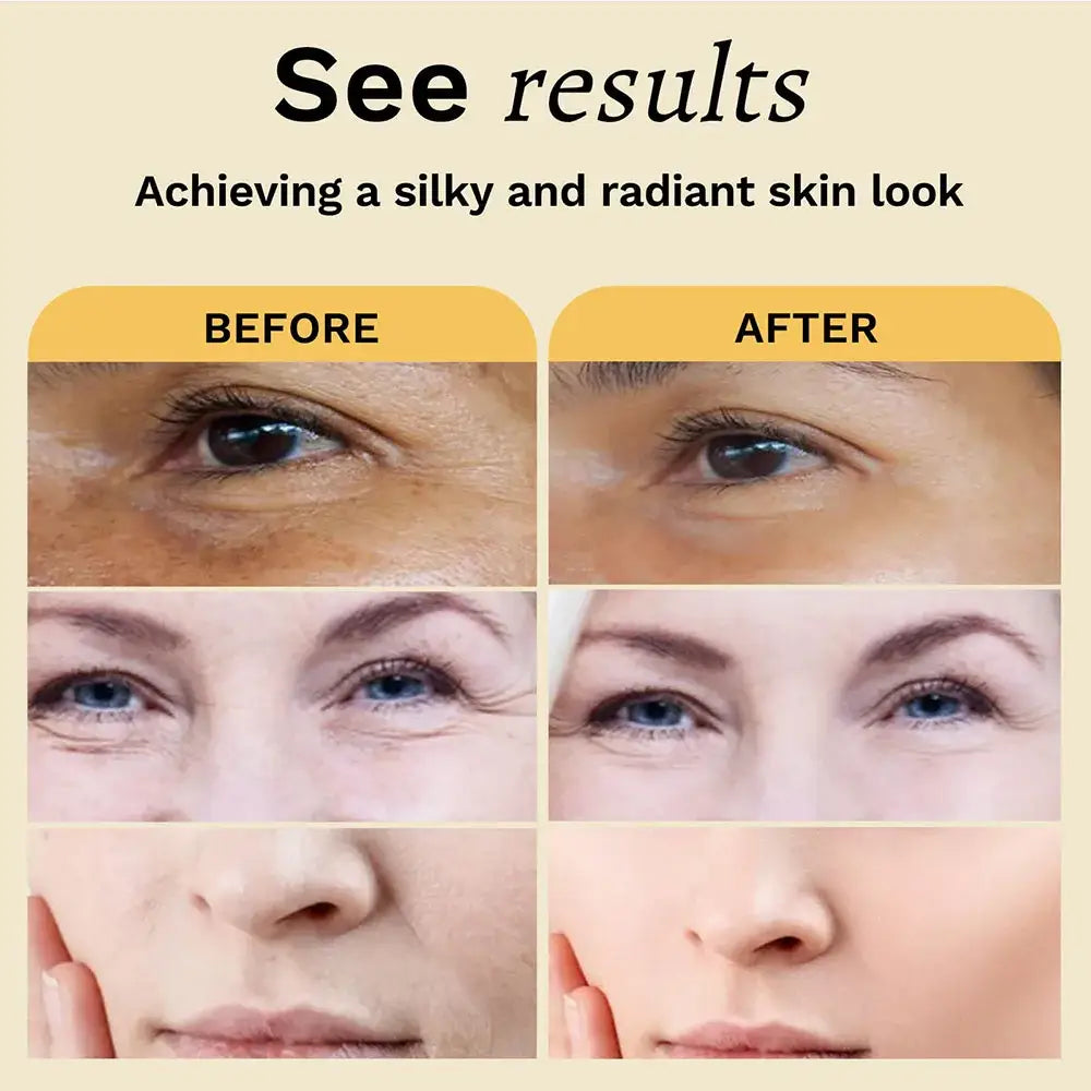 Before and after comparison of skin appearance, showing improvements in texture and radiance.