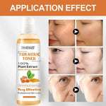 Dr. Meinaier Turmeric Toner: Acne and Hyperpigmentation Results - Vignette | VogueBeautify