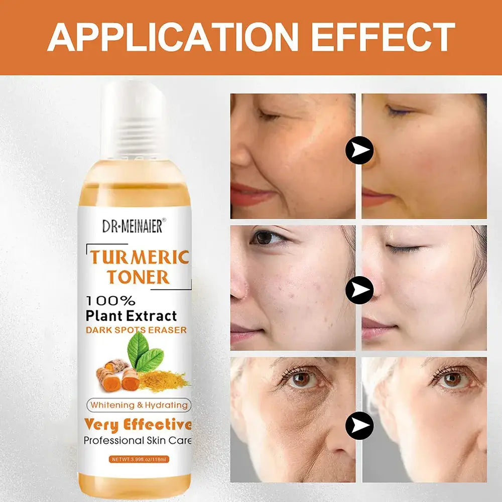 Bottle of Dr. Meihauer Turmeric Toner with before-and-after skin comparison images.