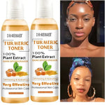 Dr. Meinaier Turmeric Toner: Acne and Hyperpigmentation Results - Vignette | VogueBeautify