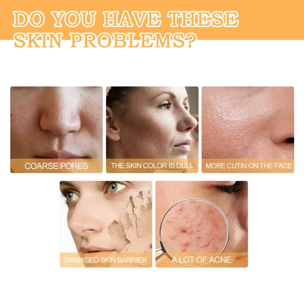 Advertisement for skin care products highlighting common skin problems like coarse pores, dull skin tone, oily skin, and acne.