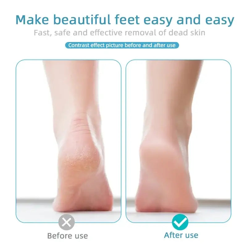 Human feet shown in a before-and-after comparison to demonstrate the effects of a foot care treatment.