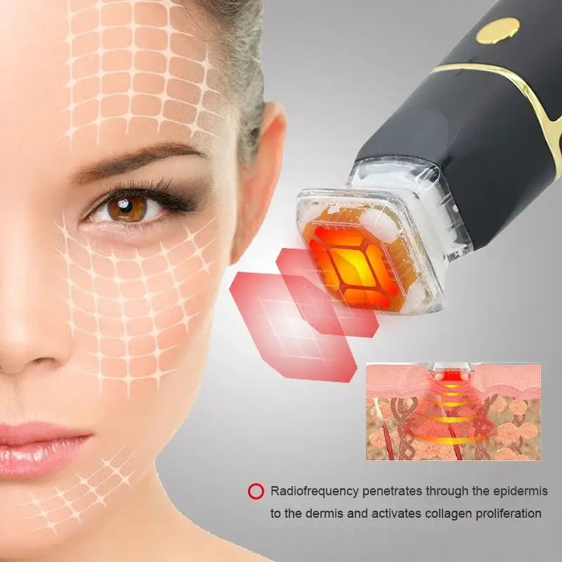 Close-up view of a person’s face with a radiofrequency device targeting the skin.