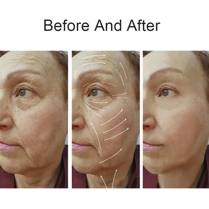 Three-panel ’Before and After’ comparison showing facial skin changes.