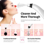 Facial Pore Cleaner with Suction Technology - Vignette | VogueBeautify