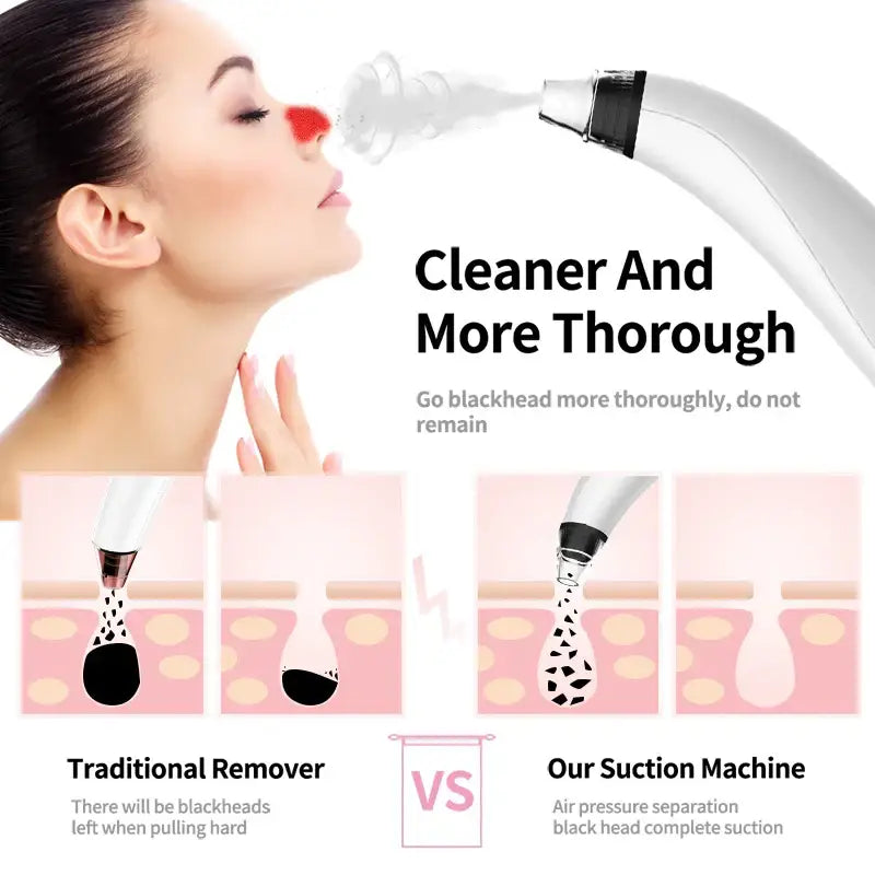 Facial pore cleaner device with suction technology for blackhead removal.