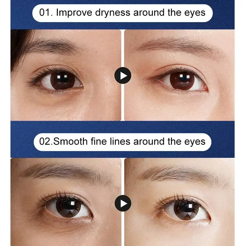 Before-and-after comparison of eye treatments showing improvements in dryness and fine lines around the eyes.