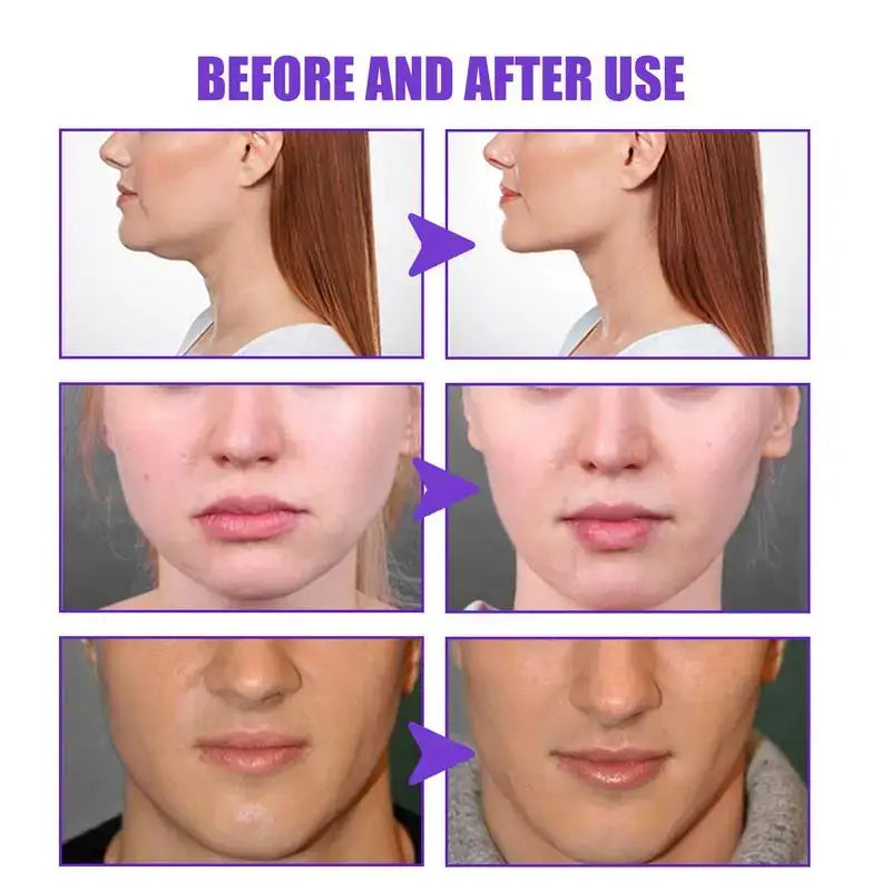 Before and after comparison of facial profiles and jawlines, showing changes in appearance.