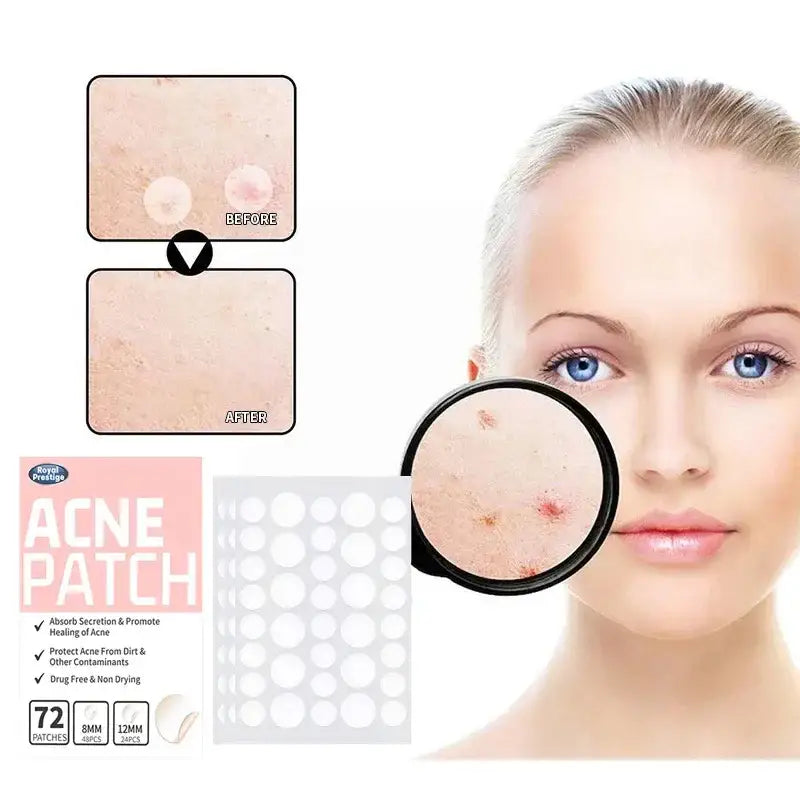 Acne patch product with before and after skin comparison.