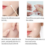 Flawless Skin Acne Patches - Vignette | VogueBeautify