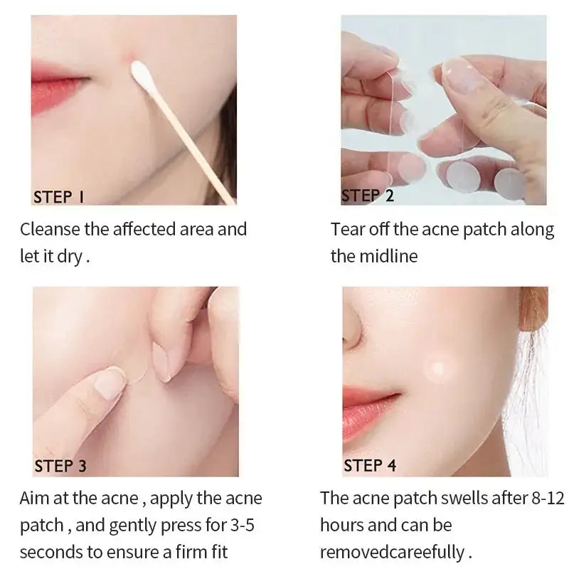 Step-by-step instructions for applying an acne patch to the skin.