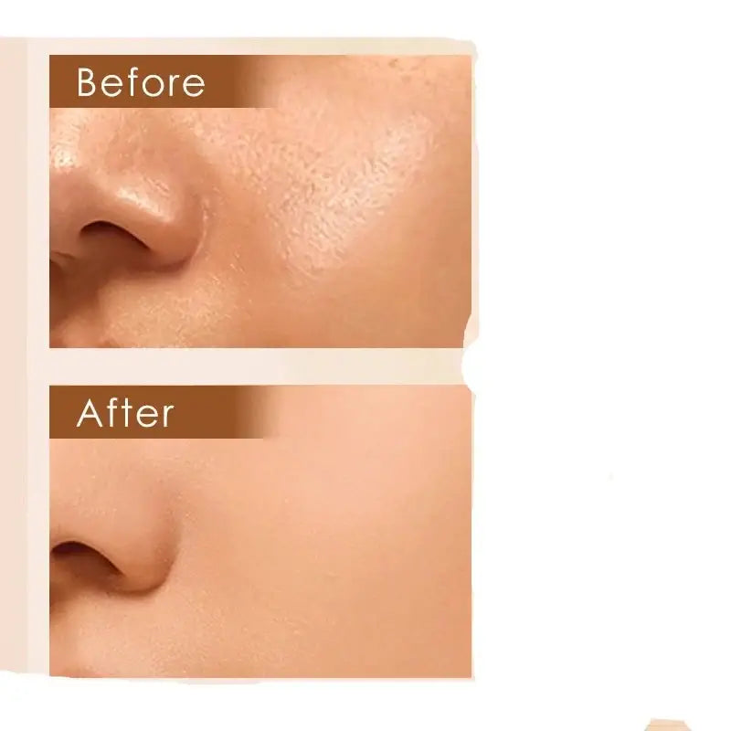 Close-up comparison of skin texture before and after treatment, showing reduced pores and smoother appearance.