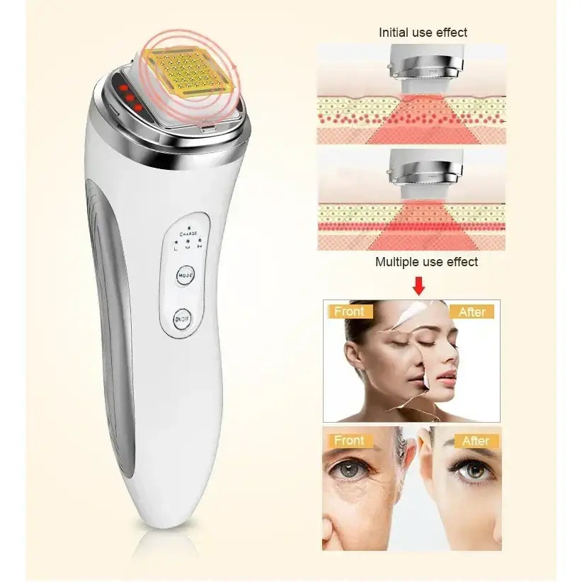 Handheld electronic beauty device with a golden treatment head and control buttons.