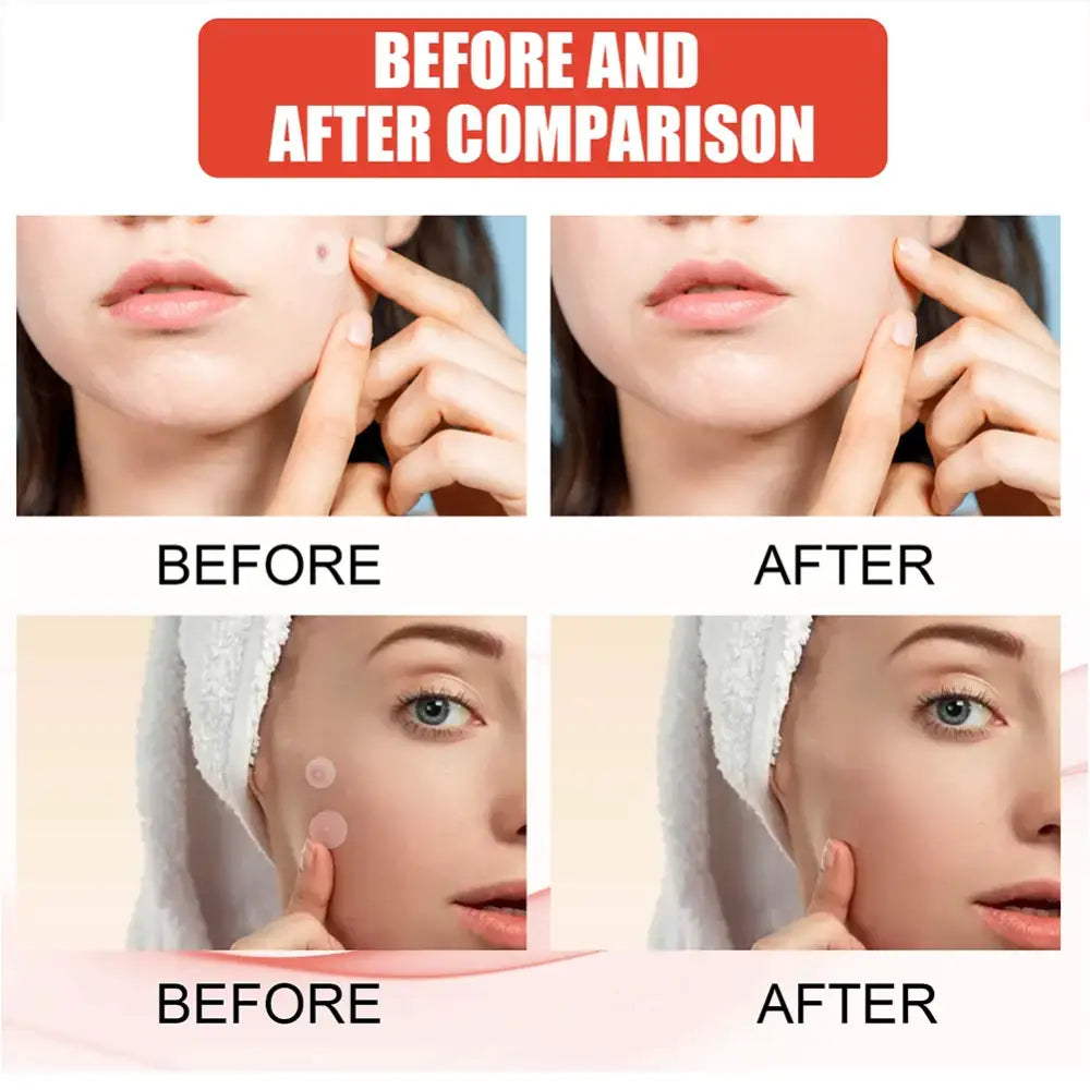 Before and after comparison of skin appearance, showing close-up facial images.