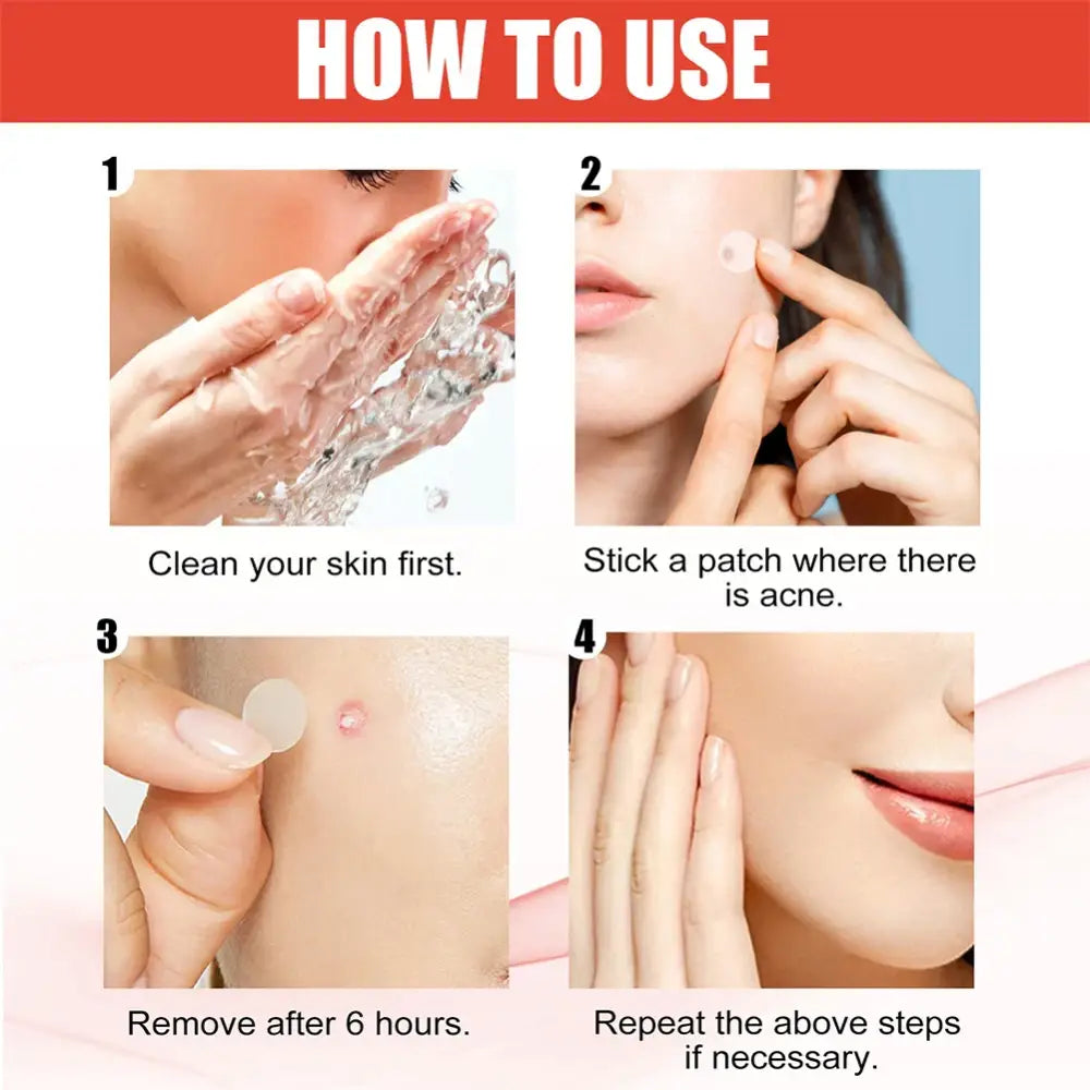 Step-by-step instructions for using acne patches or spot treatments.