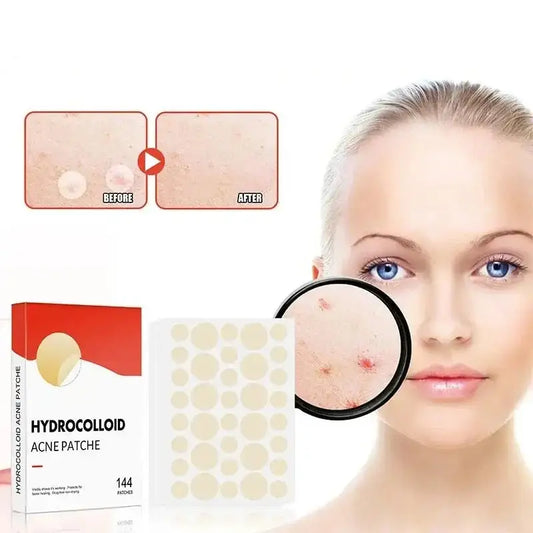 Hydrocolloid acne patch product with before and after skin comparison.