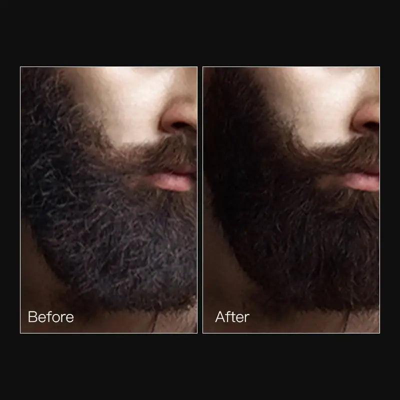 Beard shown in before and after comparison photos.