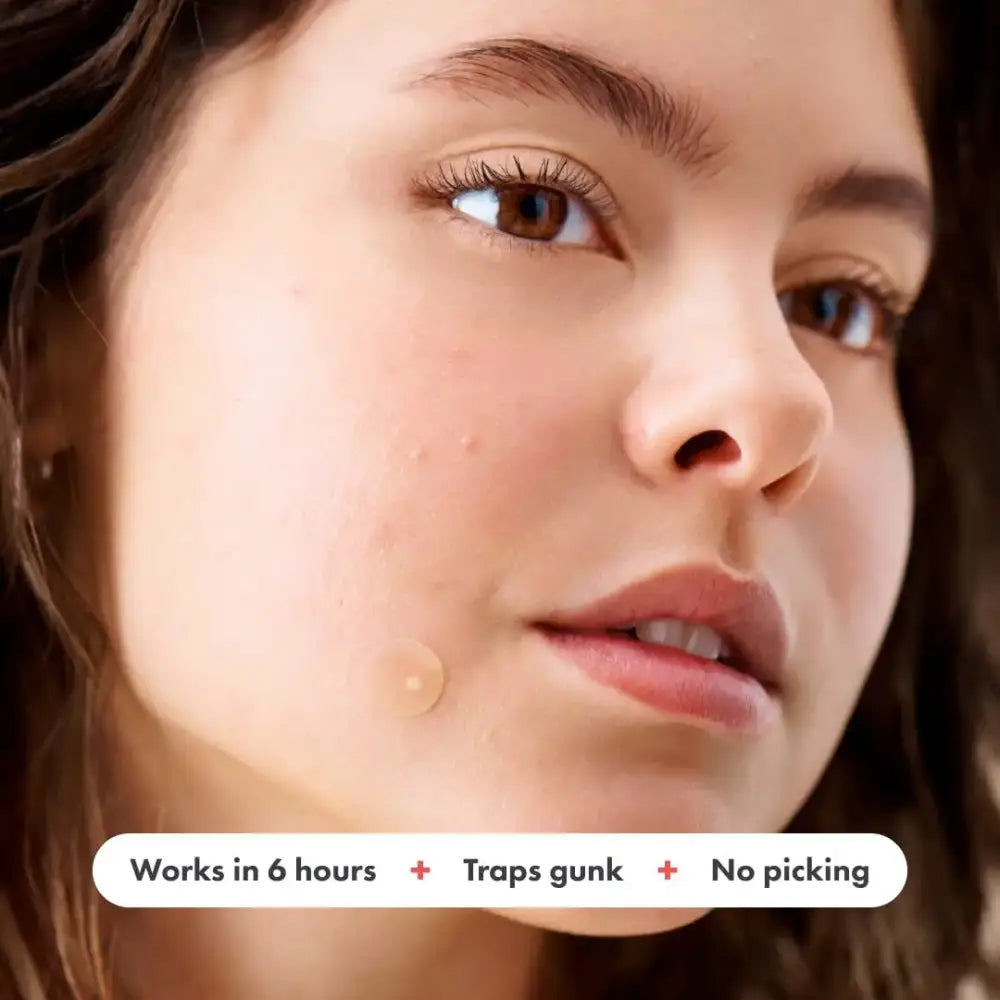 Close-up portrait of a young woman with clear skin and brown eyes.