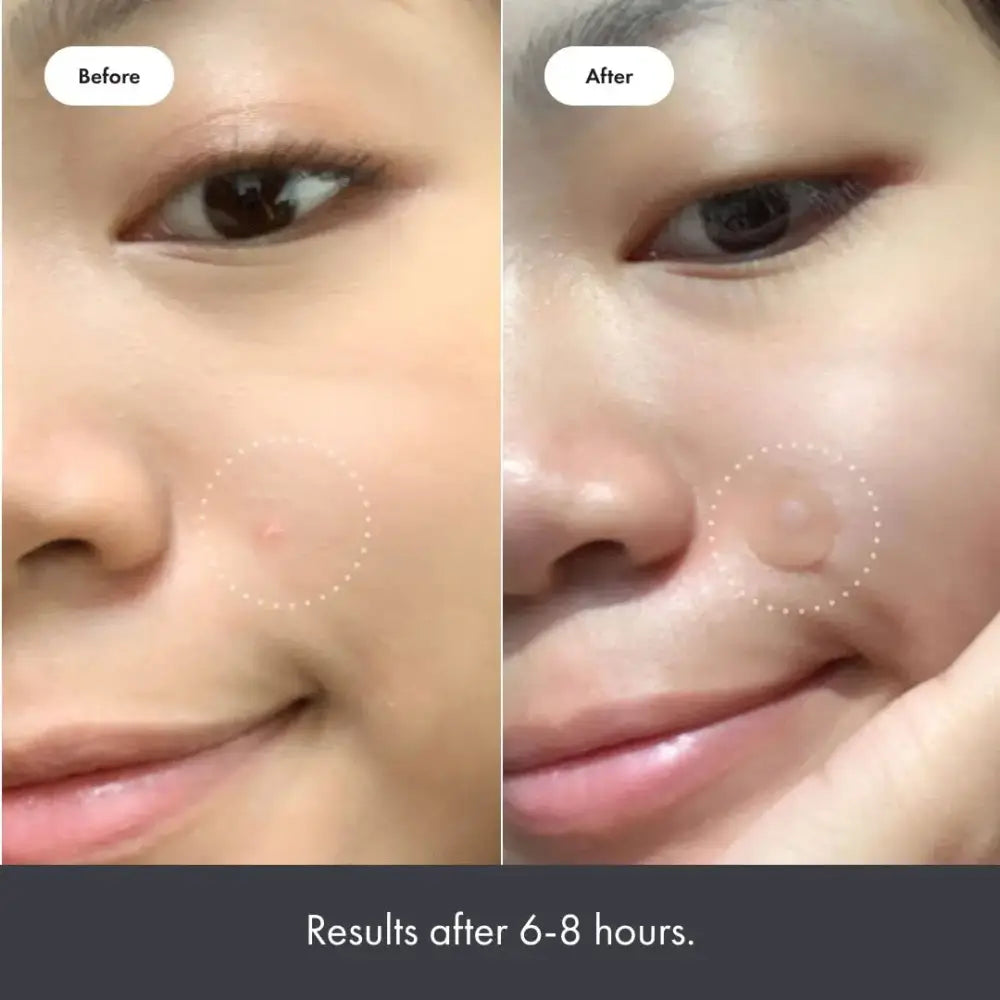 Before and after comparison of facial skin showing improved hydration and plumpness.