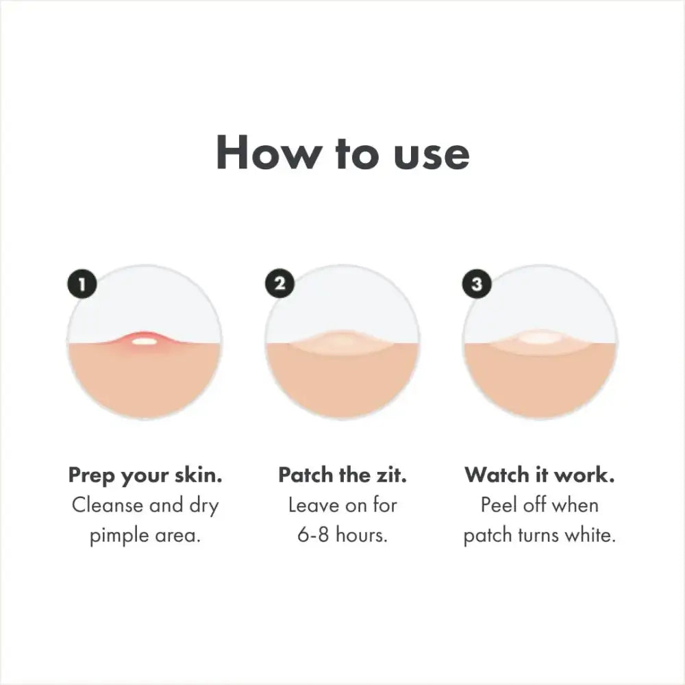 Instructional diagram showing three steps for using a pimple patch or acne treatment.