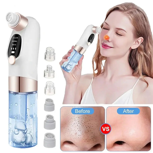 Facial pore cleaner device with attachments and before/after comparison images.