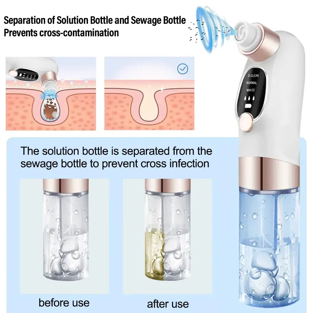 Nasal irrigation device with separate solution and sewage bottles to prevent cross-contamination.