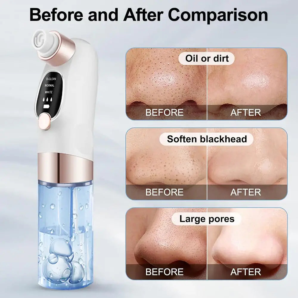 Skincare device with before and after comparison photos showing its effects on skin issues.