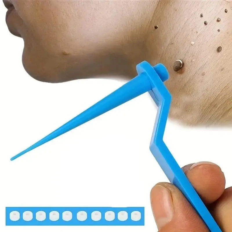 Blue plastic tool for removing blackheads or extracting pimples.