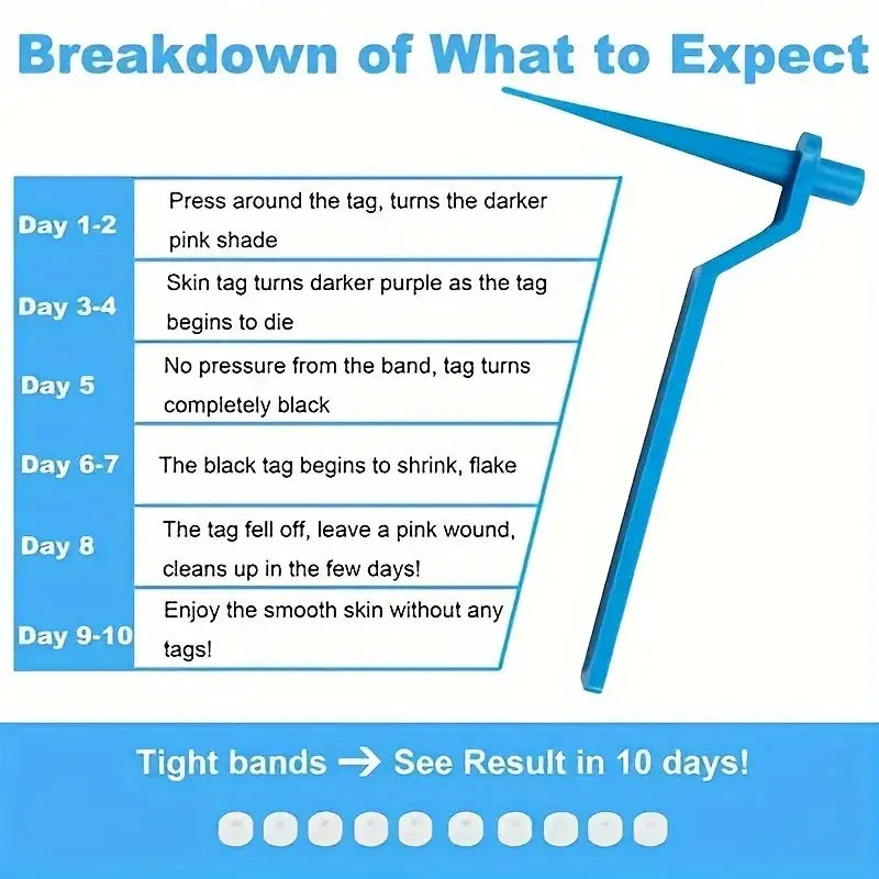 Breakdown chart showing the daily progression of skin tag removal using tight bands over 10 days.