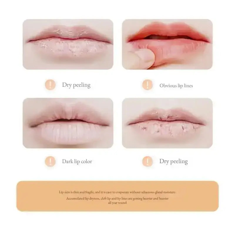 Collage of close-up lip images showing different skin conditions.