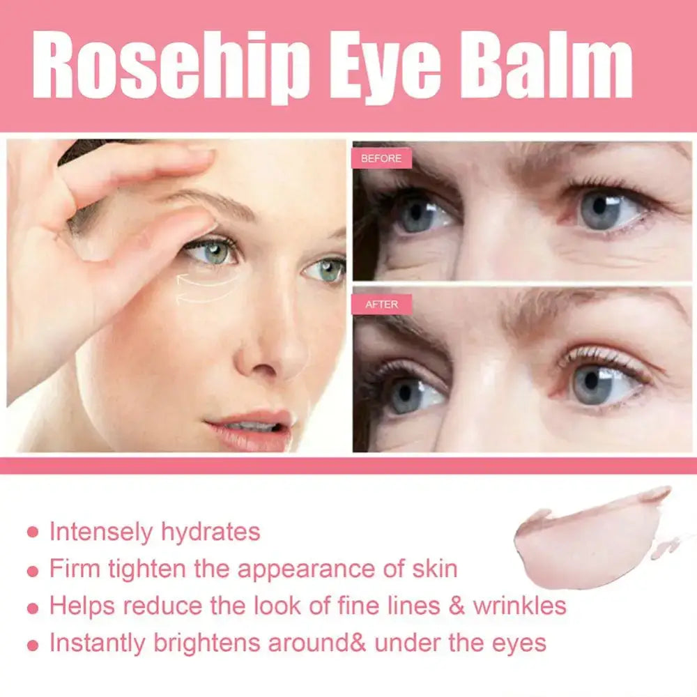 Advertisement for rosehip eye balm showing before and after images of eye areas and product benefits.