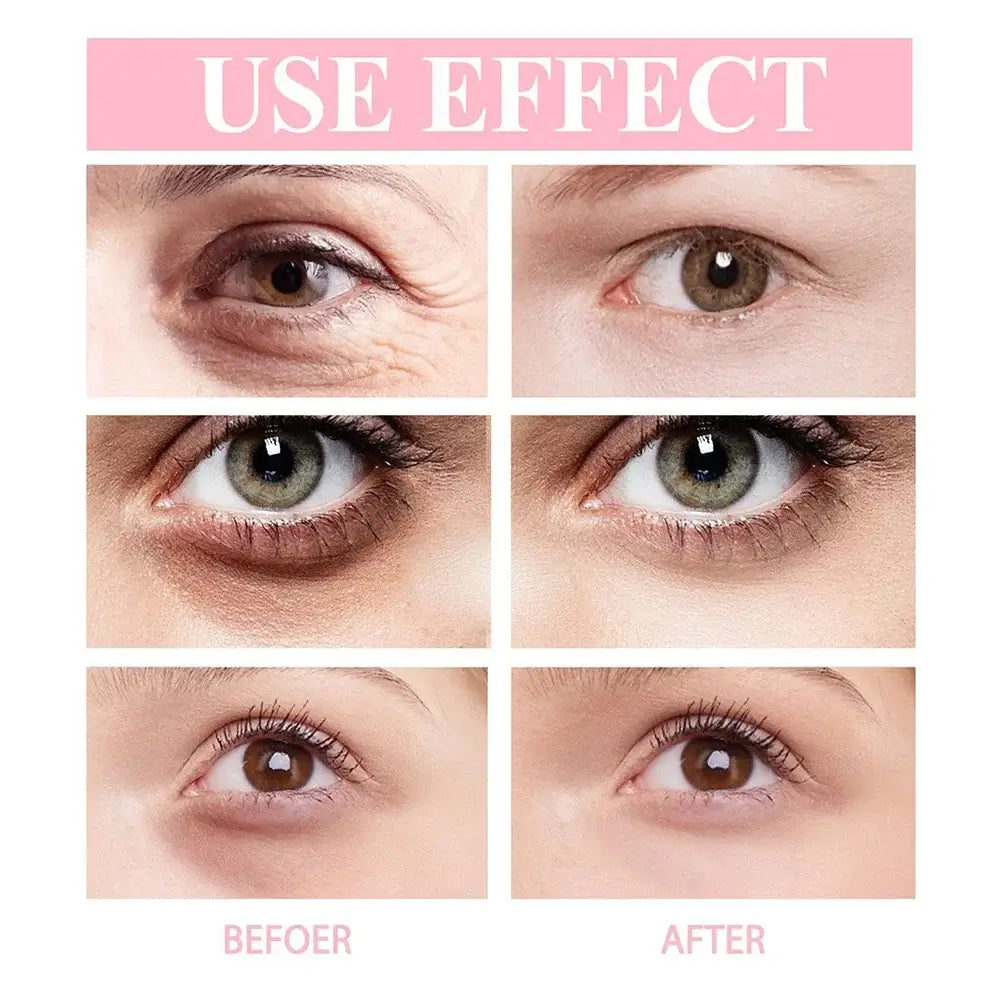 Comparison of eye areas showing before and after effects of a cosmetic treatment.