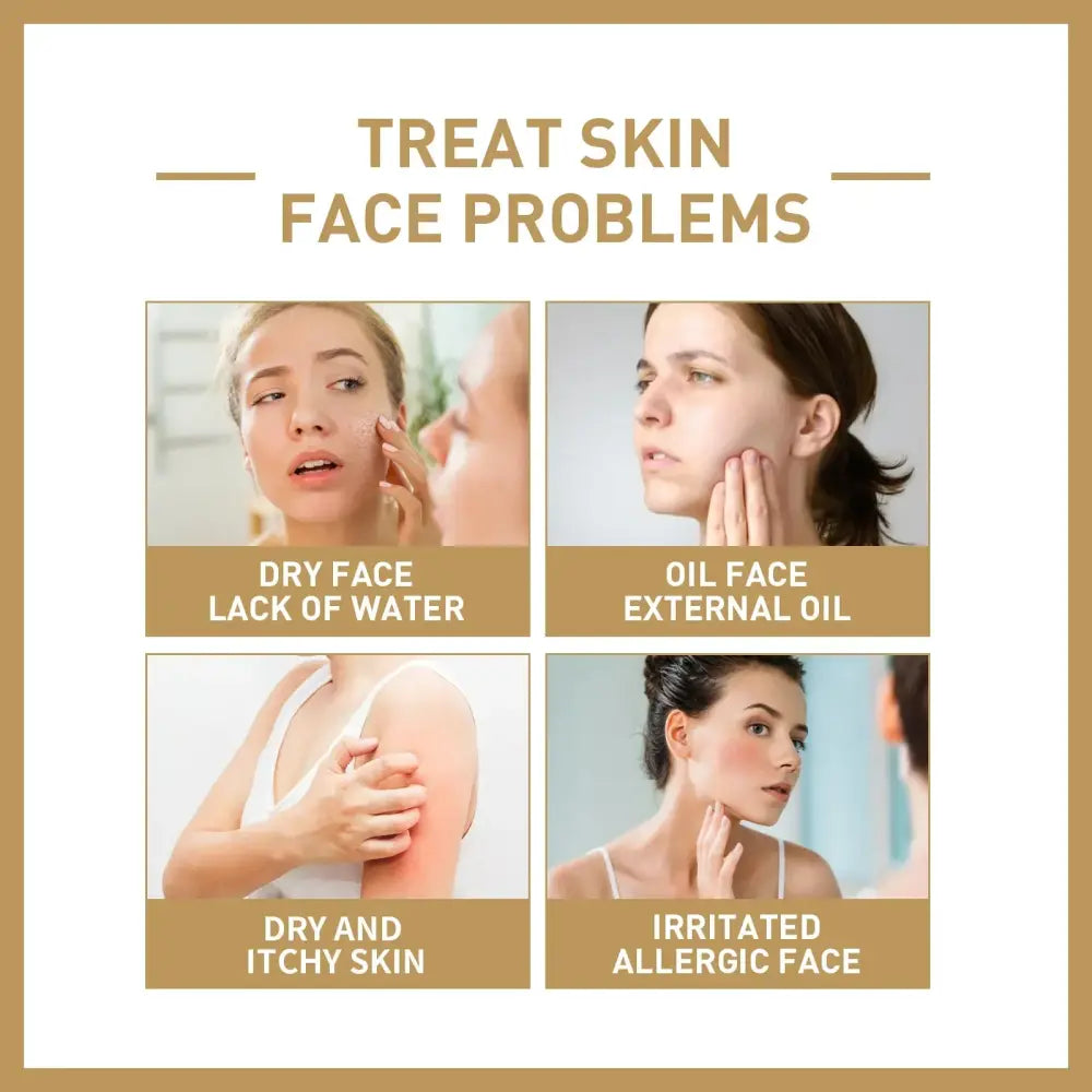 Infographic showing four common facial skin problems and their characteristics.