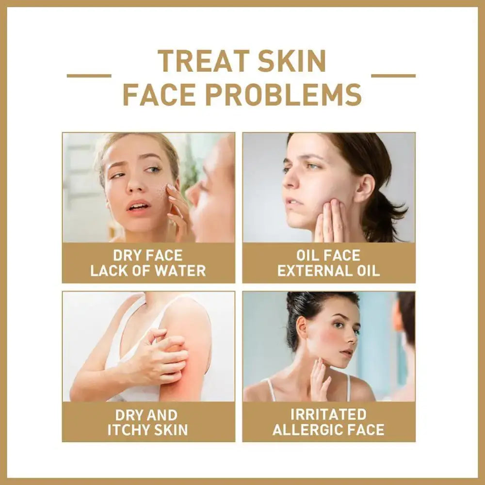 Infographic showing four common skin and face problems with corresponding images.