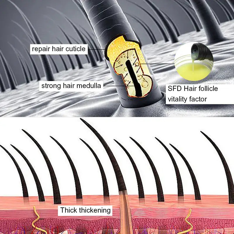 Cross-section diagram of a hair follicle and surrounding skin layers, illustrating various hair growth factors and processes.