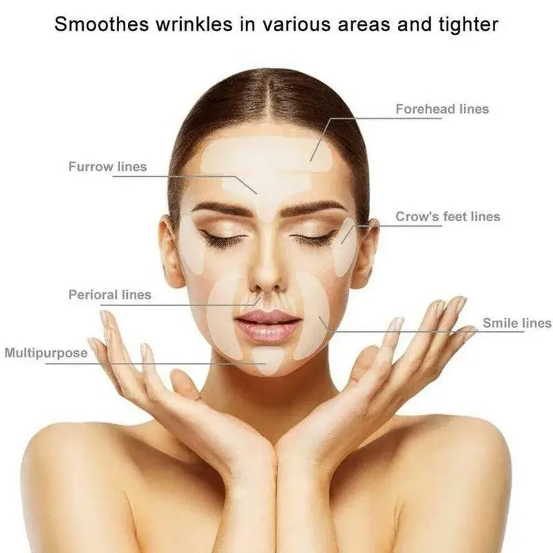 Woman’s face with labeled areas indicating different types of facial wrinkles and lines.