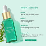 Tea Tree Acne Treatment Serum - Vignette | VogueBeautify