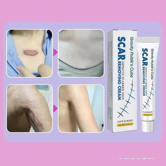 Scar removal cream product with before and after skin images.