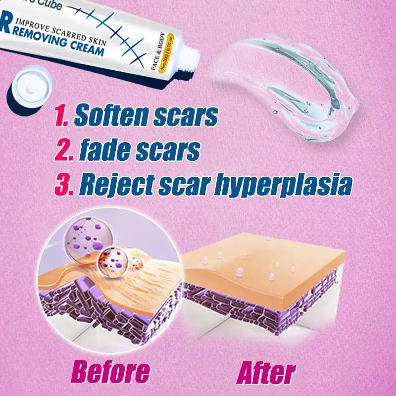 Scar removing cream tube with before and after skin diagrams.