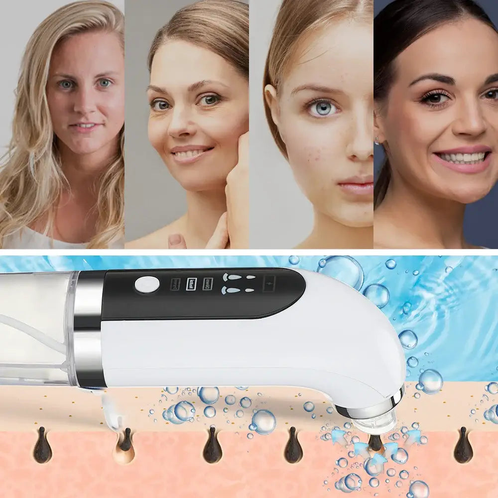 Handheld electronic skin care device with multiple attachment heads.