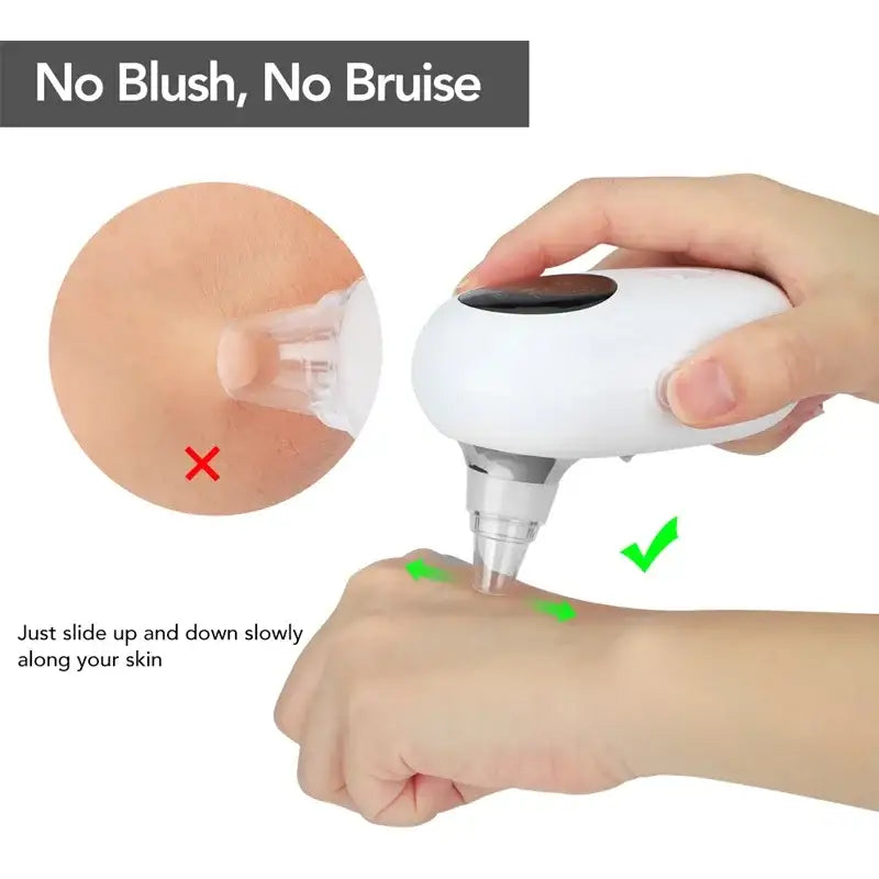 Handheld electronic device for removing hair or blemishes from skin.