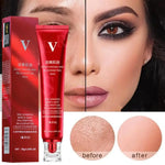 V Skincare Product with Before and After Results - Vignette | VogueBeautify